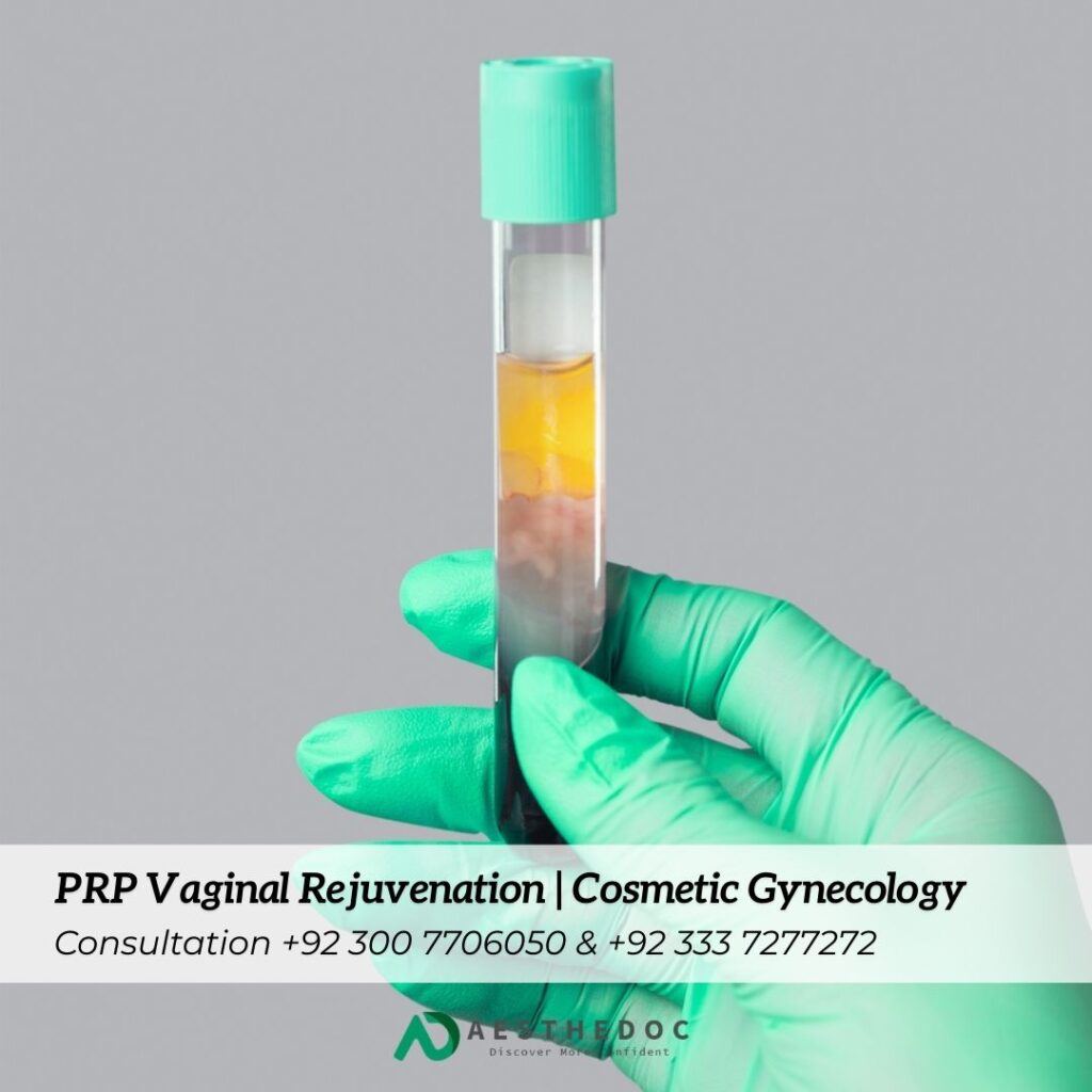 PRP Vaginal Rejuvenation Cosmetic Gynecology Clinic